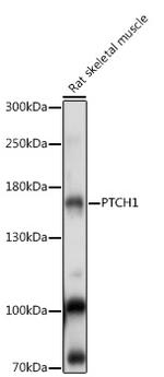 PTCH Antibody in Western Blot (WB)