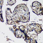 PTRF Antibody in Immunohistochemistry (Paraffin) (IHC (P))