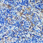 PTRF Antibody in Immunohistochemistry (Paraffin) (IHC (P))