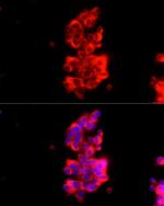 RAB27A Antibody in Immunocytochemistry (ICC/IF)