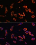 RAB5B Antibody in Immunocytochemistry (ICC/IF)