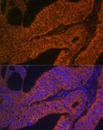 RAB5B Antibody in Immunohistochemistry (Paraffin) (IHC (P))