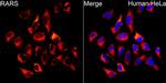 RARS Antibody in Immunocytochemistry (ICC/IF)