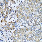 RARS Antibody in Immunohistochemistry (Paraffin) (IHC (P))