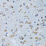 RARS Antibody in Immunohistochemistry (Paraffin) (IHC (P))