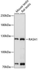 RASA1 Antibody in Western Blot (WB)