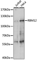 RBM12 Antibody in Western Blot (WB)