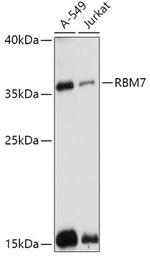 RBM7 Antibody in Western Blot (WB)