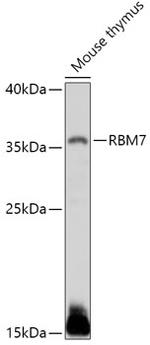 RBM7 Antibody in Western Blot (WB)