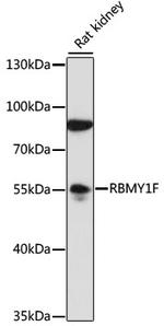 RBMY1F Antibody in Western Blot (WB)