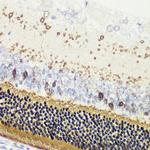 Recoverin Antibody in Immunohistochemistry (Paraffin) (IHC (P))