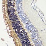 Recoverin Antibody in Immunohistochemistry (Paraffin) (IHC (P))