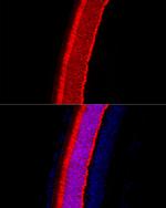 Recoverin Antibody in Immunohistochemistry (Paraffin) (IHC (P))