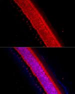 Recoverin Antibody in Immunohistochemistry (Paraffin) (IHC (P))