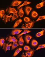 RIG-I Antibody in Immunocytochemistry (ICC/IF)