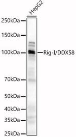 RIG-I Antibody in Western Blot (WB)