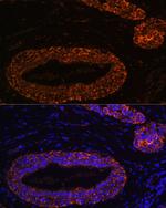 RNF31 Antibody in Immunohistochemistry (Paraffin) (IHC (P))