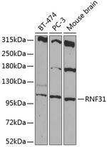 RNF31 Antibody in Western Blot (WB)