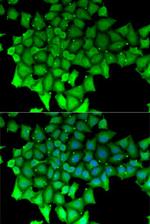 HCE Antibody in Immunocytochemistry (ICC/IF)