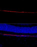 RPE65 Antibody in Immunocytochemistry (ICC/IF)