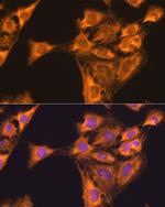 RPL23 Antibody in Immunocytochemistry (ICC/IF)