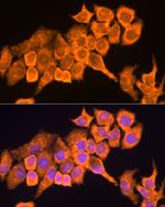 RPL23 Antibody in Immunocytochemistry (ICC/IF)