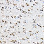 RPL23 Antibody in Immunohistochemistry (Paraffin) (IHC (P))