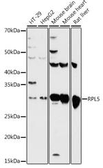 RPL5 Antibody in Western Blot (WB)