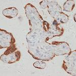 SARS2 Antibody in Immunohistochemistry (Paraffin) (IHC (P))