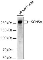 SCN5A Antibody in Western Blot (WB)