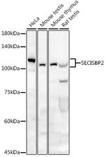 SBP2 Antibody in Western Blot (WB)