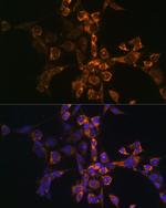 ARTS Antibody in Immunocytochemistry (ICC/IF)