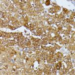 ARTS Antibody in Immunohistochemistry (Paraffin) (IHC (P))