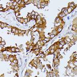 ARTS Antibody in Immunohistochemistry (Paraffin) (IHC (P))