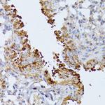 ARTS Antibody in Immunohistochemistry (Paraffin) (IHC (P))