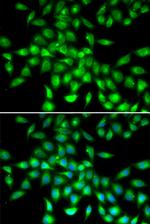 SERPINA10 Antibody in Immunocytochemistry (ICC/IF)