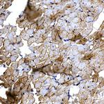 SLC14A1 Antibody in Immunohistochemistry (Paraffin) (IHC (P))