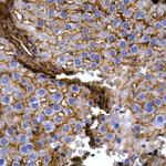 SLC14A1 Antibody in Immunohistochemistry (Paraffin) (IHC (P))