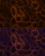 SLC14A1 Antibody in Immunohistochemistry (Paraffin) (IHC (P))