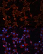 UCP4 Antibody in Immunocytochemistry (ICC/IF)