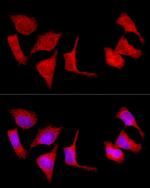 SLC27A1 Antibody in Immunocytochemistry (ICC/IF)