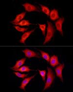 SLC27A1 Antibody in Immunocytochemistry (ICC/IF)