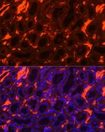 SLC4A1 Antibody in Immunohistochemistry (Paraffin) (IHC (P))