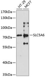 SLC5A6 Antibody in Western Blot (WB)