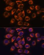 SMAP1 Antibody in Immunocytochemistry (ICC/IF)