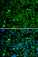 SMYD4 Antibody in Immunocytochemistry (ICC/IF)