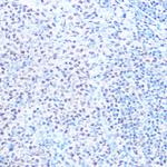 SNRPB Antibody in Immunohistochemistry (Paraffin) (IHC (P))