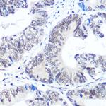 SNRPB Antibody in Immunohistochemistry (Paraffin) (IHC (P))