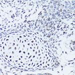 SOX5 Antibody in Immunohistochemistry (Paraffin) (IHC (P))