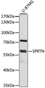 SPRTN Antibody in Western Blot (WB)